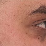 بوتاکس در کرج