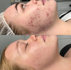 بهترین مرکز فشیال صورت کرج