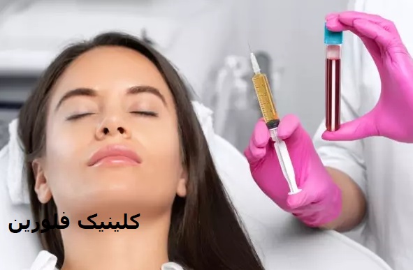 پی ارپی مو در کرج