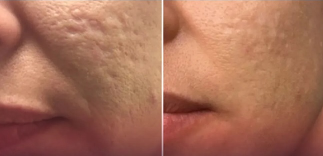 پی ار پی صورت کرج