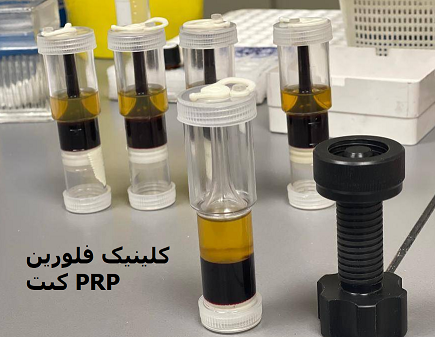 کیت های تزریق پی ار پی