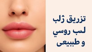 تزریق ژل لب طبیعی کرج