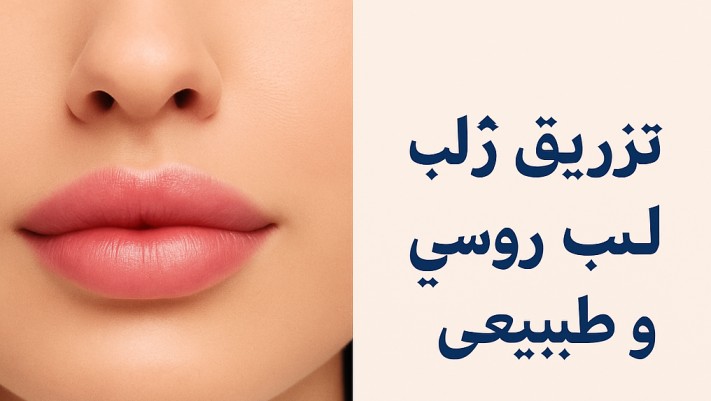 تزریق ژل لب طبیعی کرج