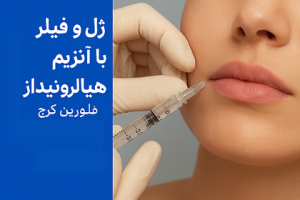 تزریق آنزیم هیالورونیداز برای حل ژل و فیلر لب در کلینیک زیبایی فلورین کرج توسط پزشک زیبایی