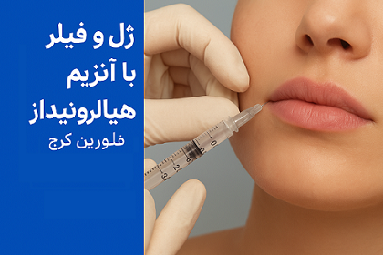 تزریق آنزیم هیالورونیداز برای حل ژل و فیلر لب در کلینیک زیبایی فلورین کرج توسط پزشک زیبایی